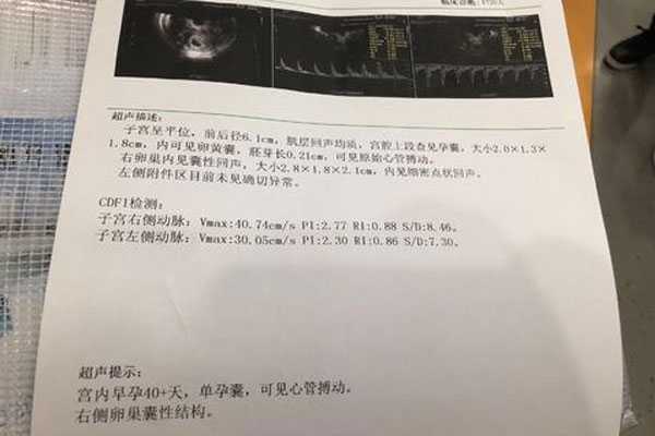 香港化验血结果是Y是不是男孩,试管婴儿移植25天后胎儿稳不稳定？25天hcg正常值