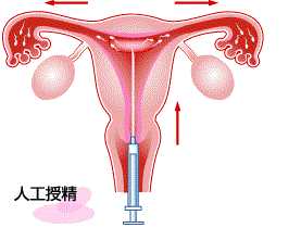 香港瑞鑫验血准吗,人工授精和试管婴儿都属人工受孕，两者有何不同？开始时